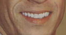 lips3.jpg